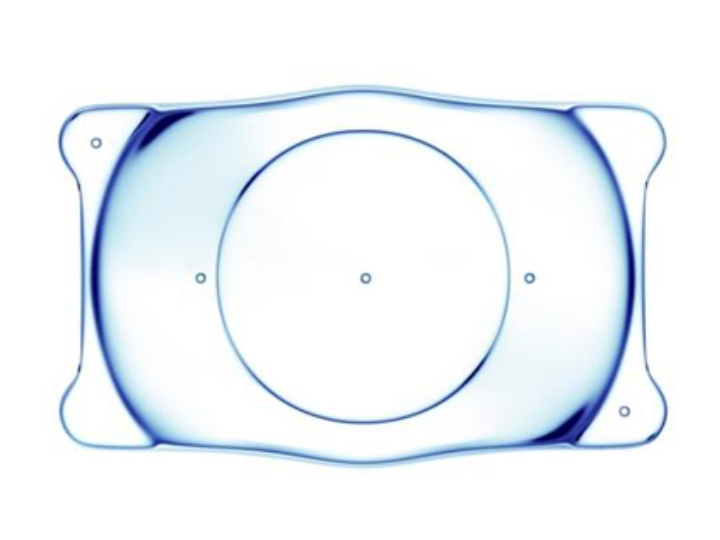 ICL眼内（コンタクトレンズ）